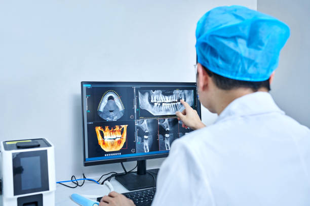 Best Emergency Wisdom Teeth Removal in Pewee Valley, KY
